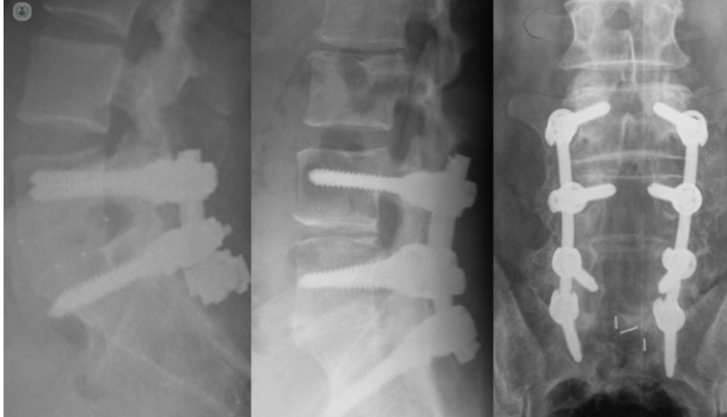 Nicomedes Fernandez-Baillo Gallego Sacristana-11