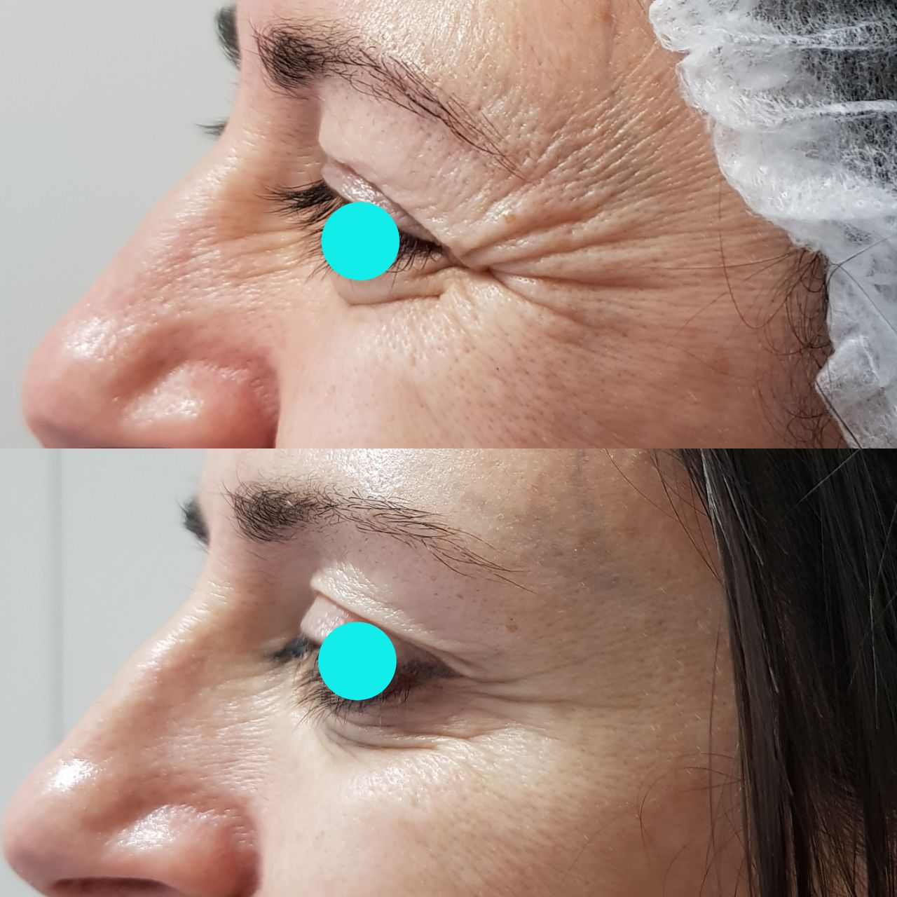 Rosalba Herrero Zerpa-444