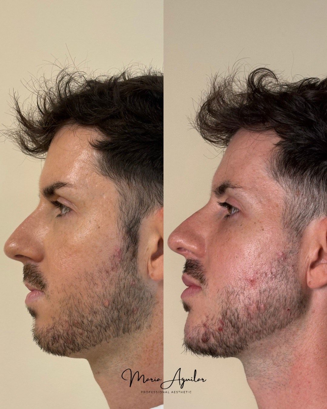 María Aguilar Pozo-16