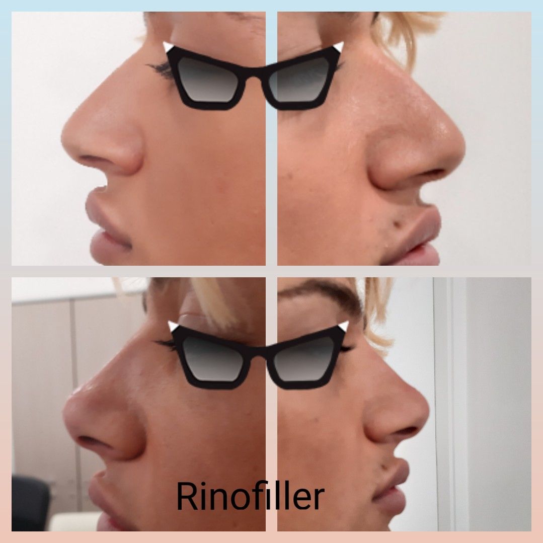 Paola Della Rocca-10