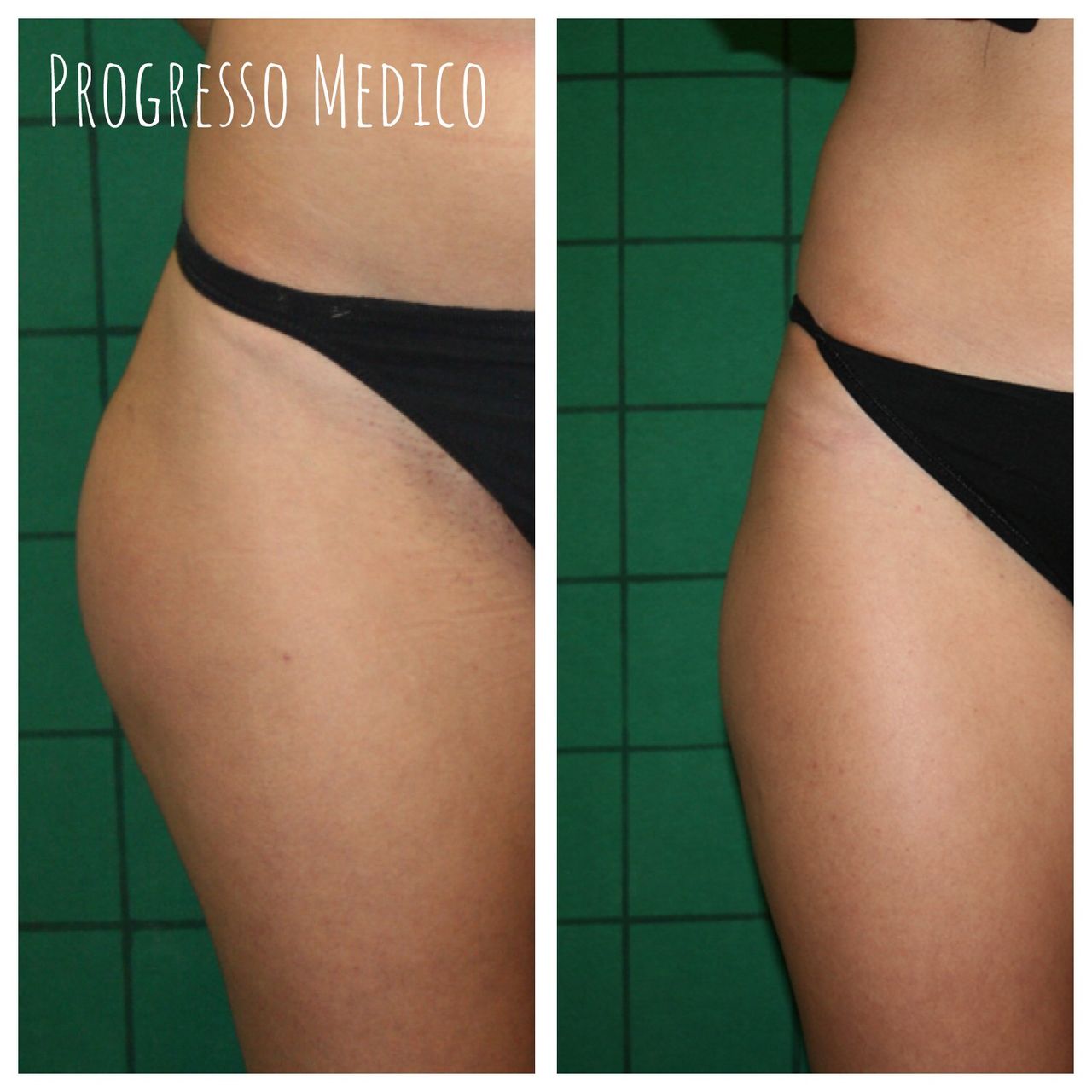 Alessandro Masellis-1