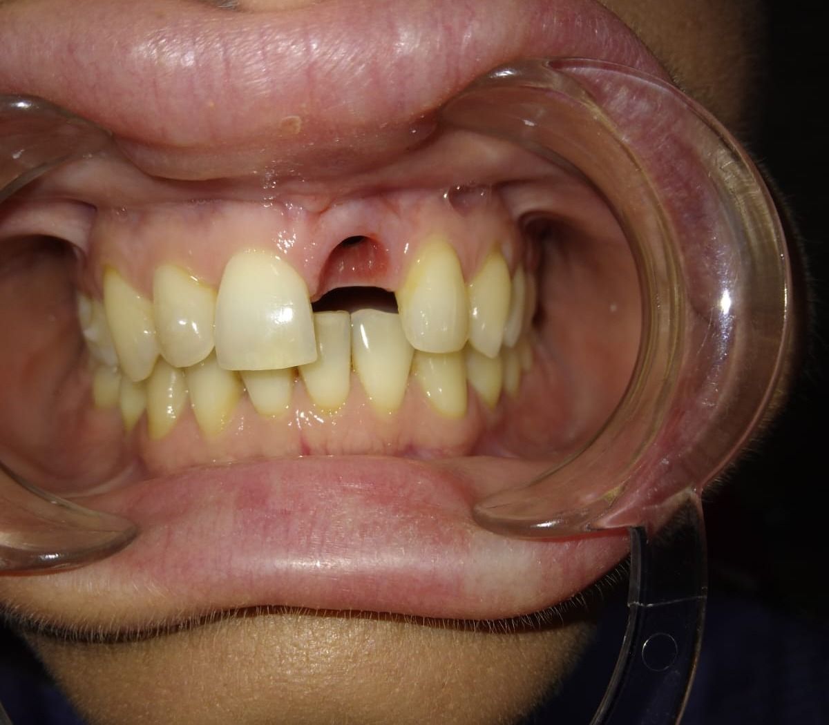 Luigi Aiardo Esposito-16