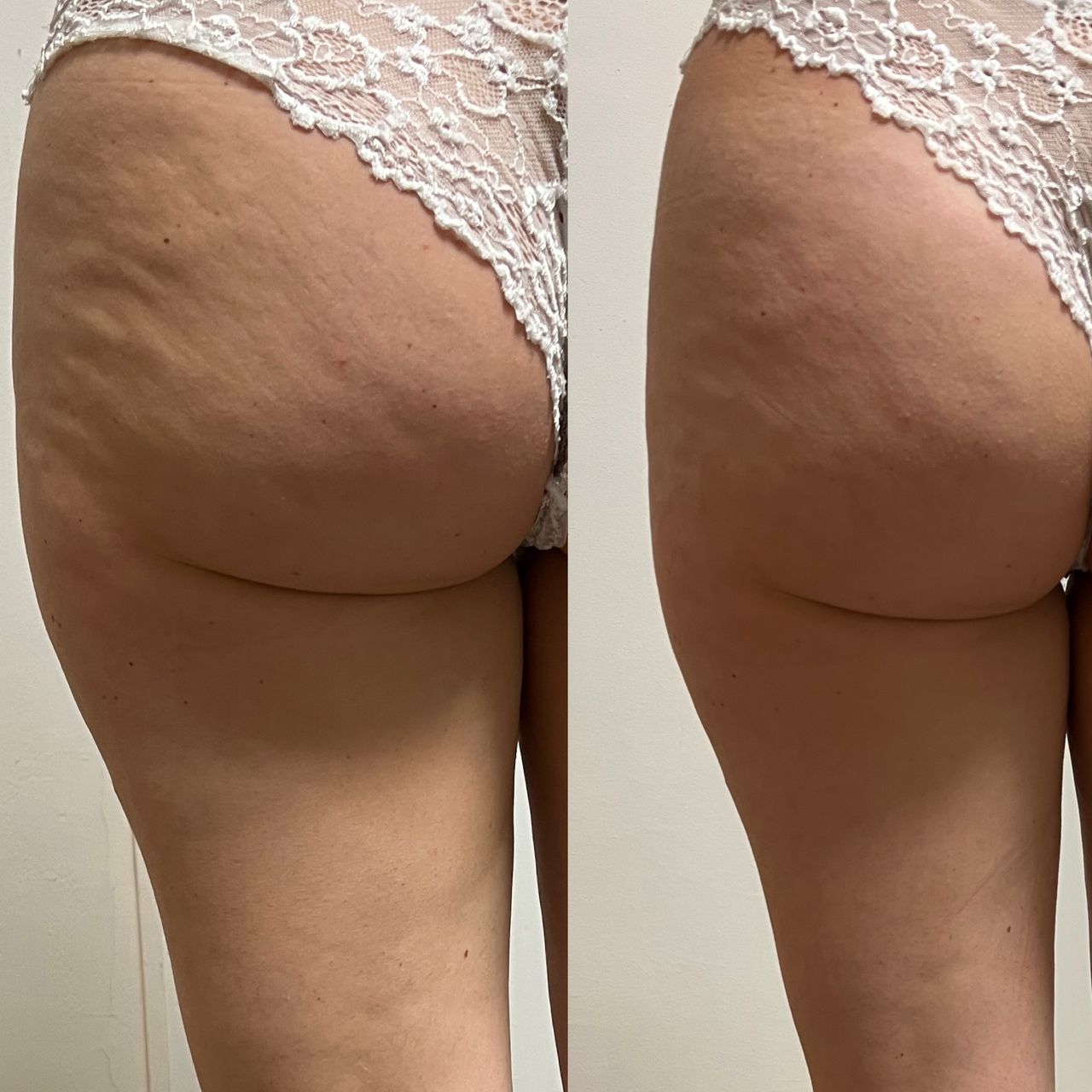 Jacopo Pettinelli-43