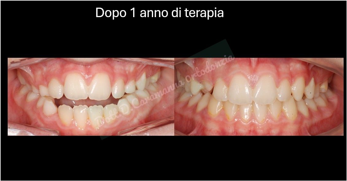 Daniele Caramanna-20