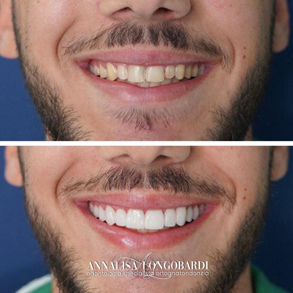 Annalisa Longobardi-7