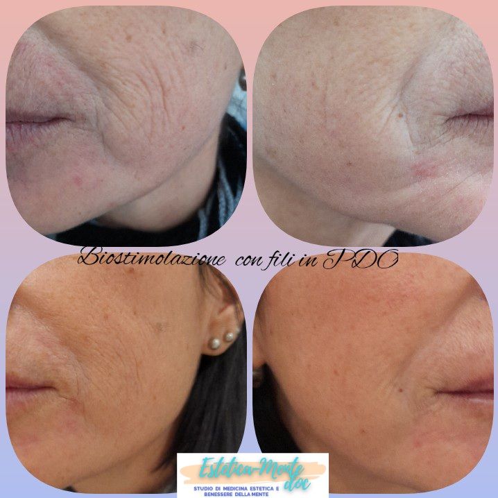 Paola Della Rocca-49