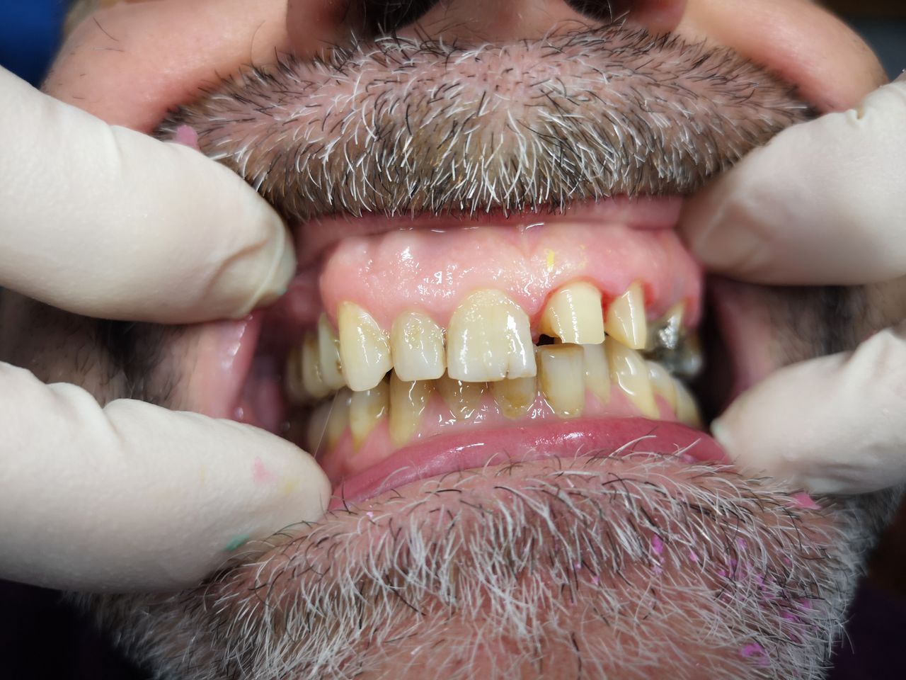 Stefano De Simone-64