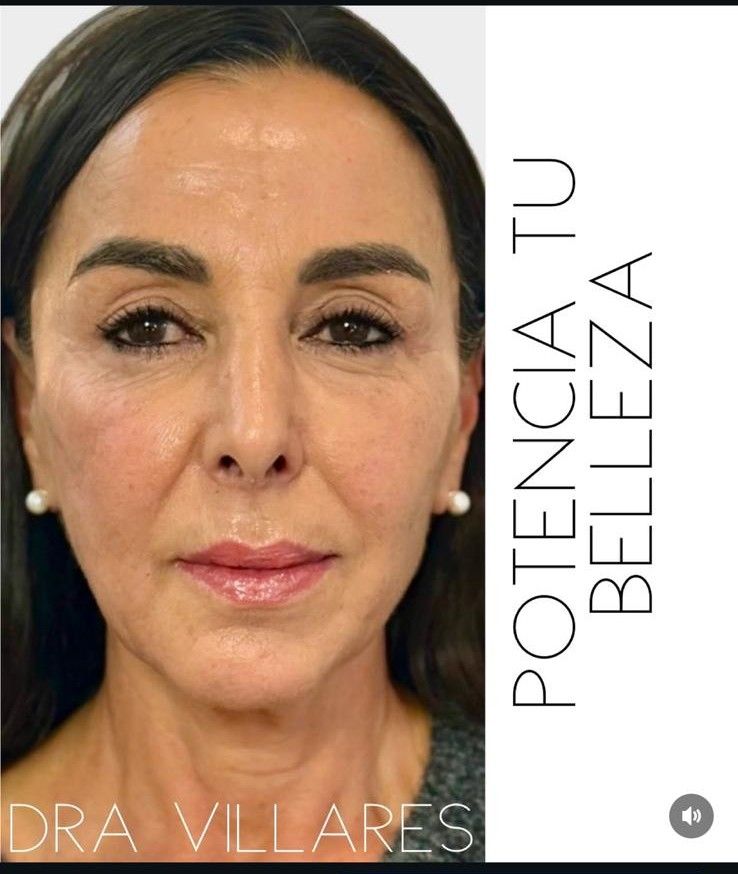 Maria Jose Villares Moreno-10