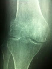 Alessio Giannuzzo-17