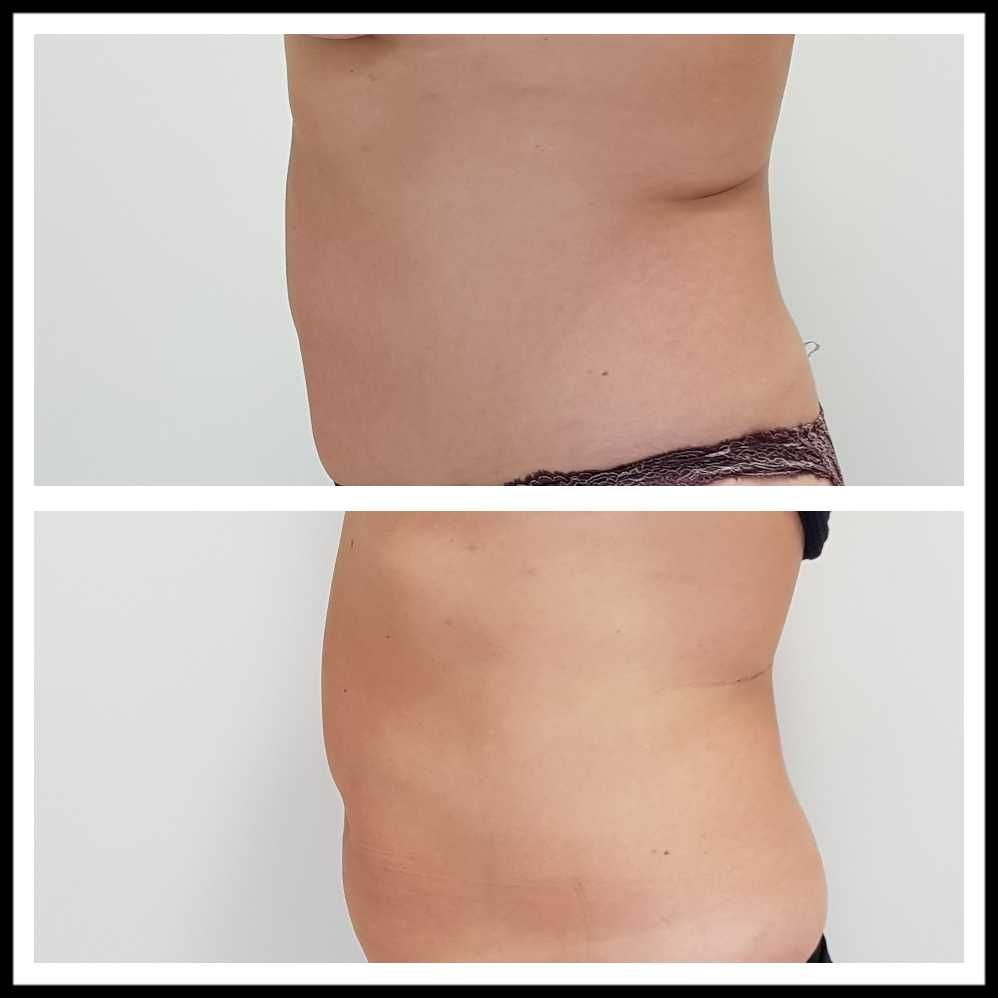 Rosalba Herrero Zerpa-365