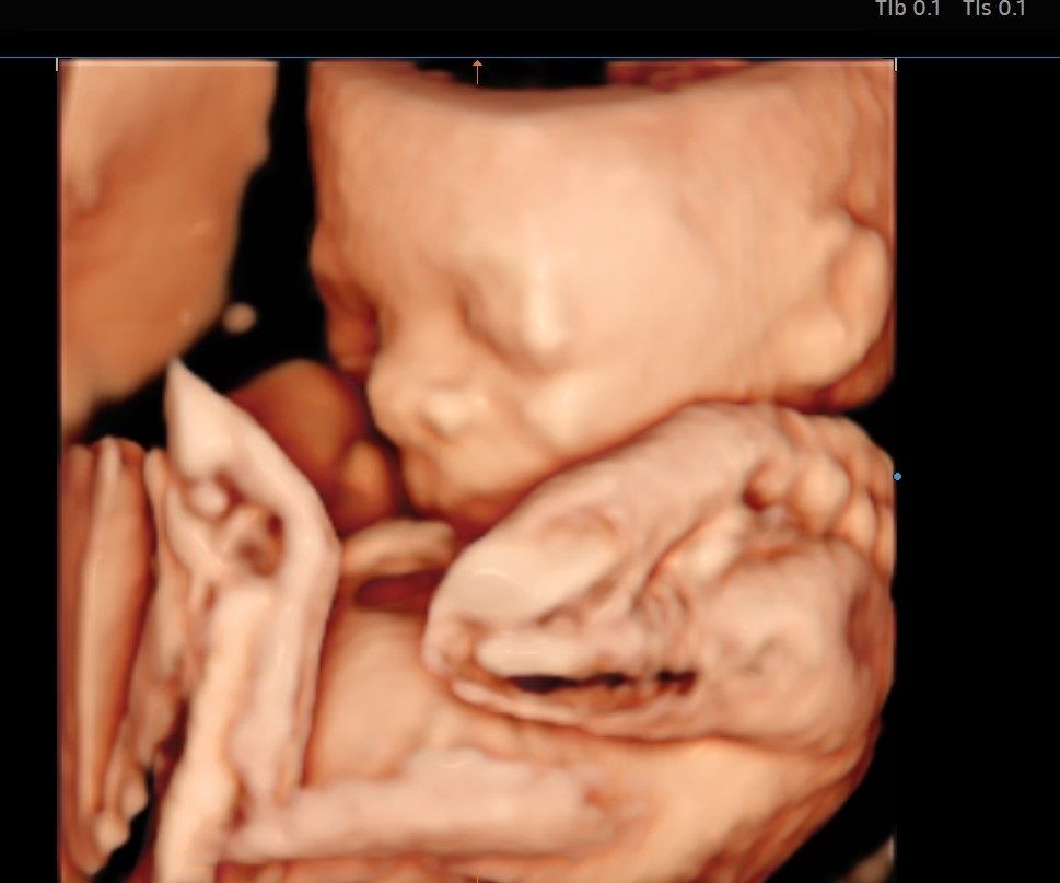 Valentina Conserva-10