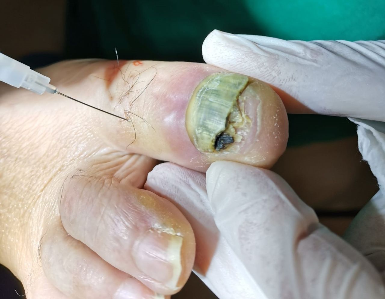 Luis Gandía Zapata-6