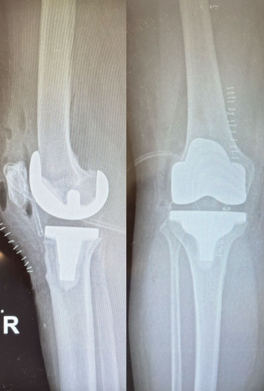 Alessandro Del Monaco-3