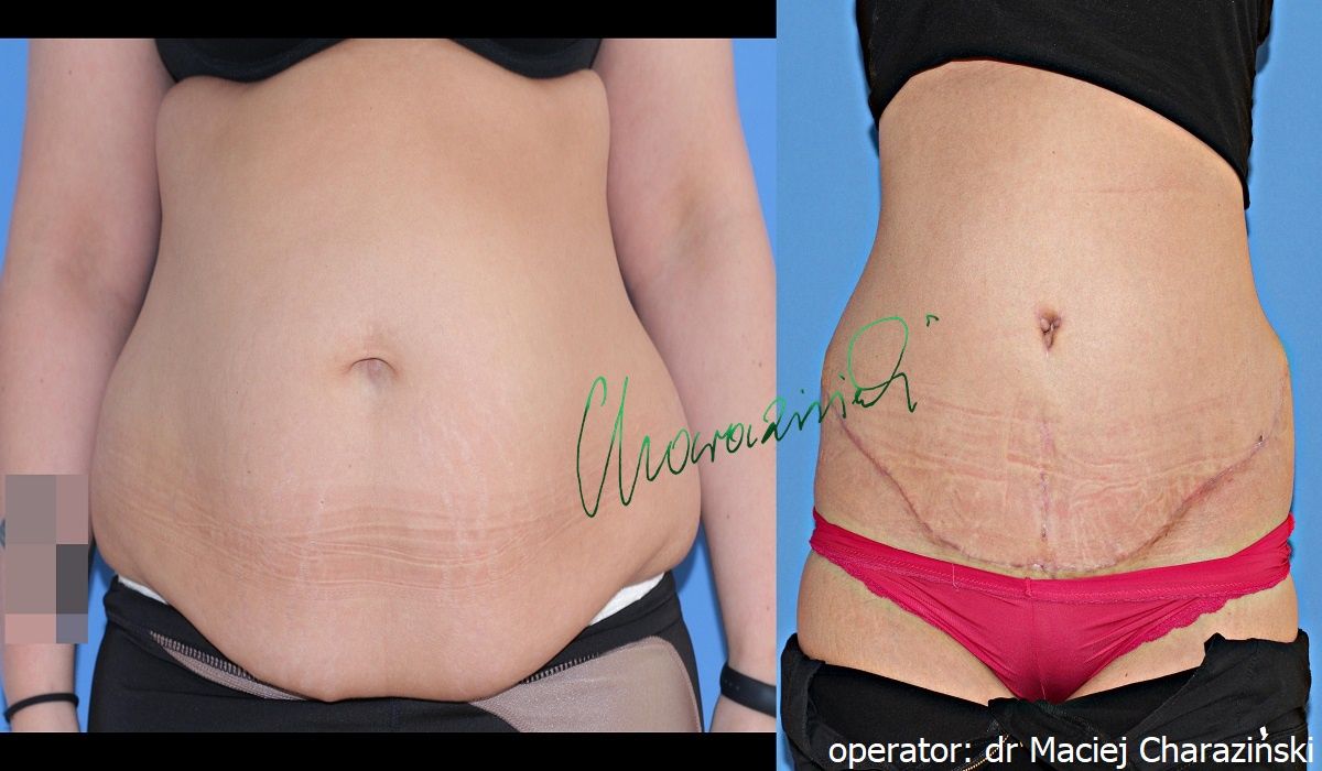 Maciej Charaziński-8