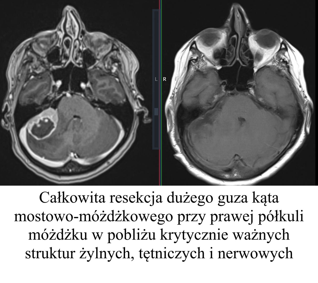 Tomasz Klepinowski-0