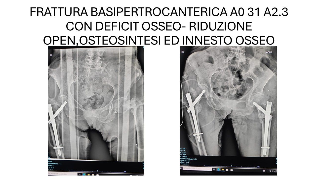 Bartolomeo D'amora-5