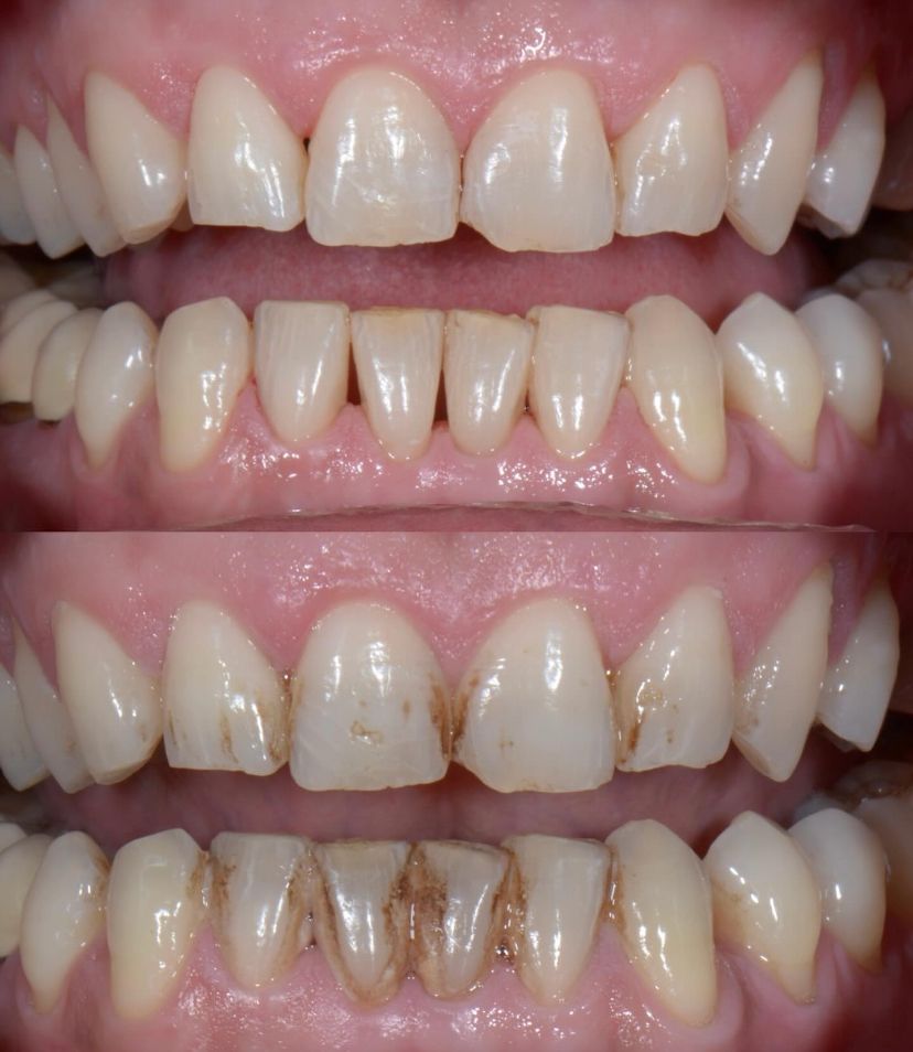 Martina Delle Cave-8