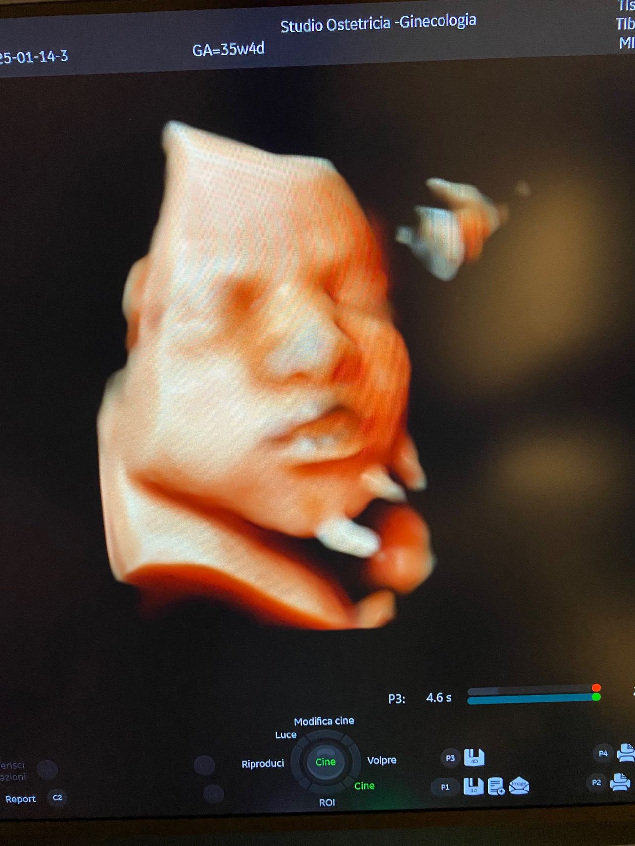 Roberto Procaccianti-6