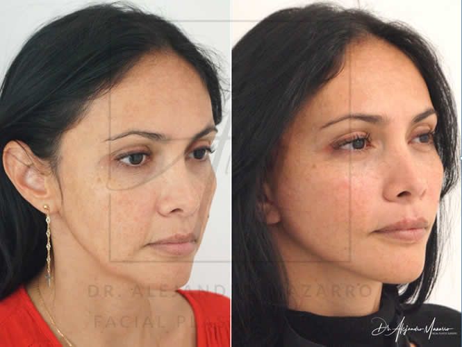 Alejandro Mazarro Campos-0