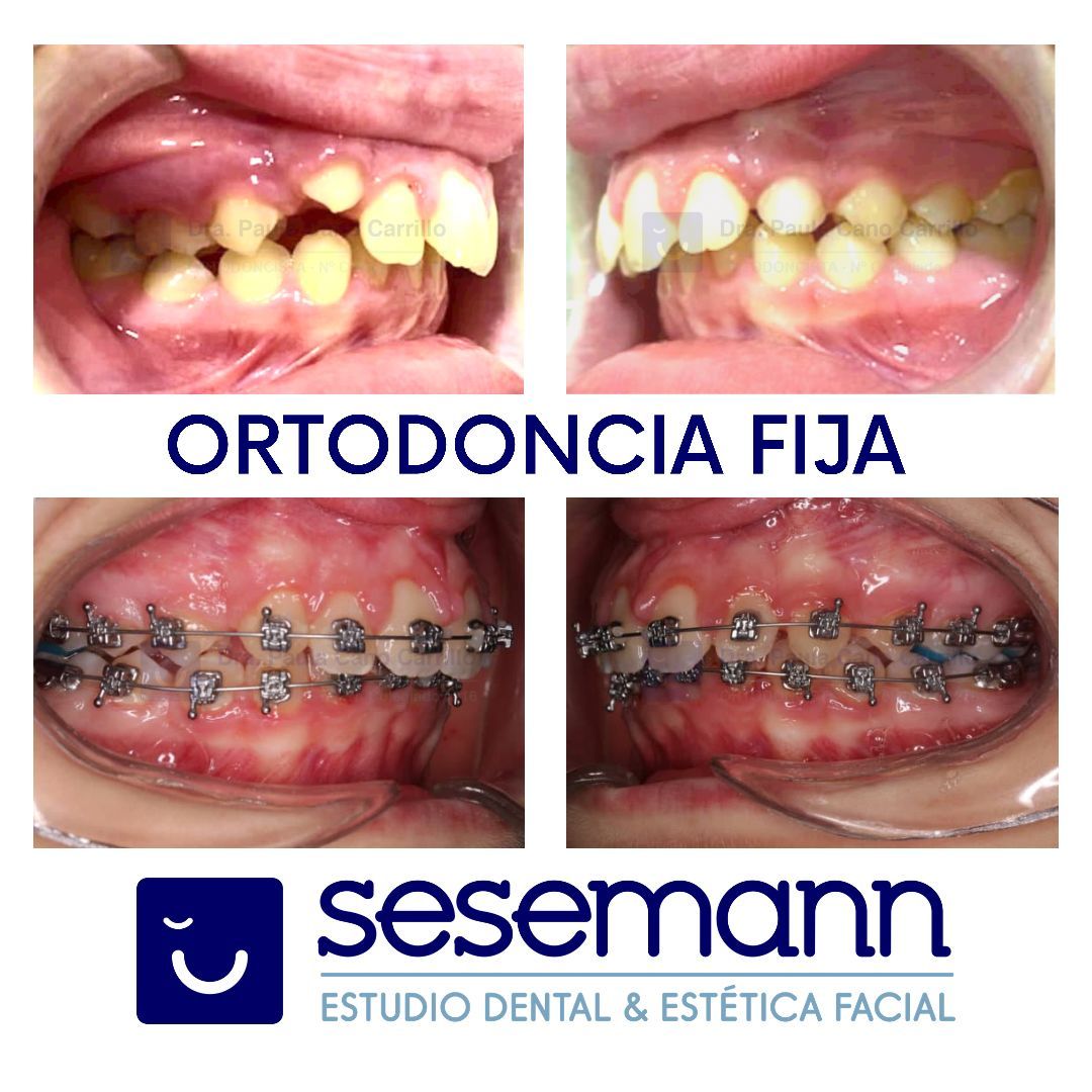 Paula Cano Carrillo-74