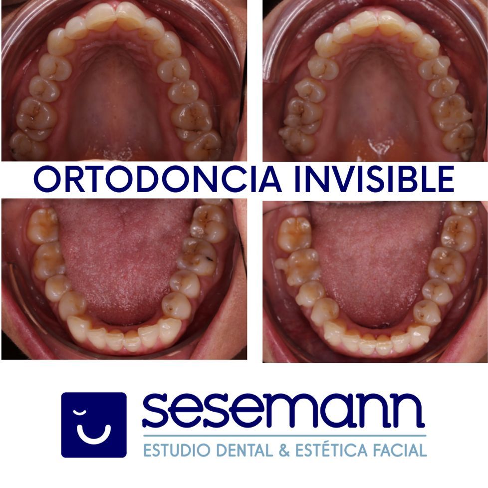 Paula Cano Carrillo-97