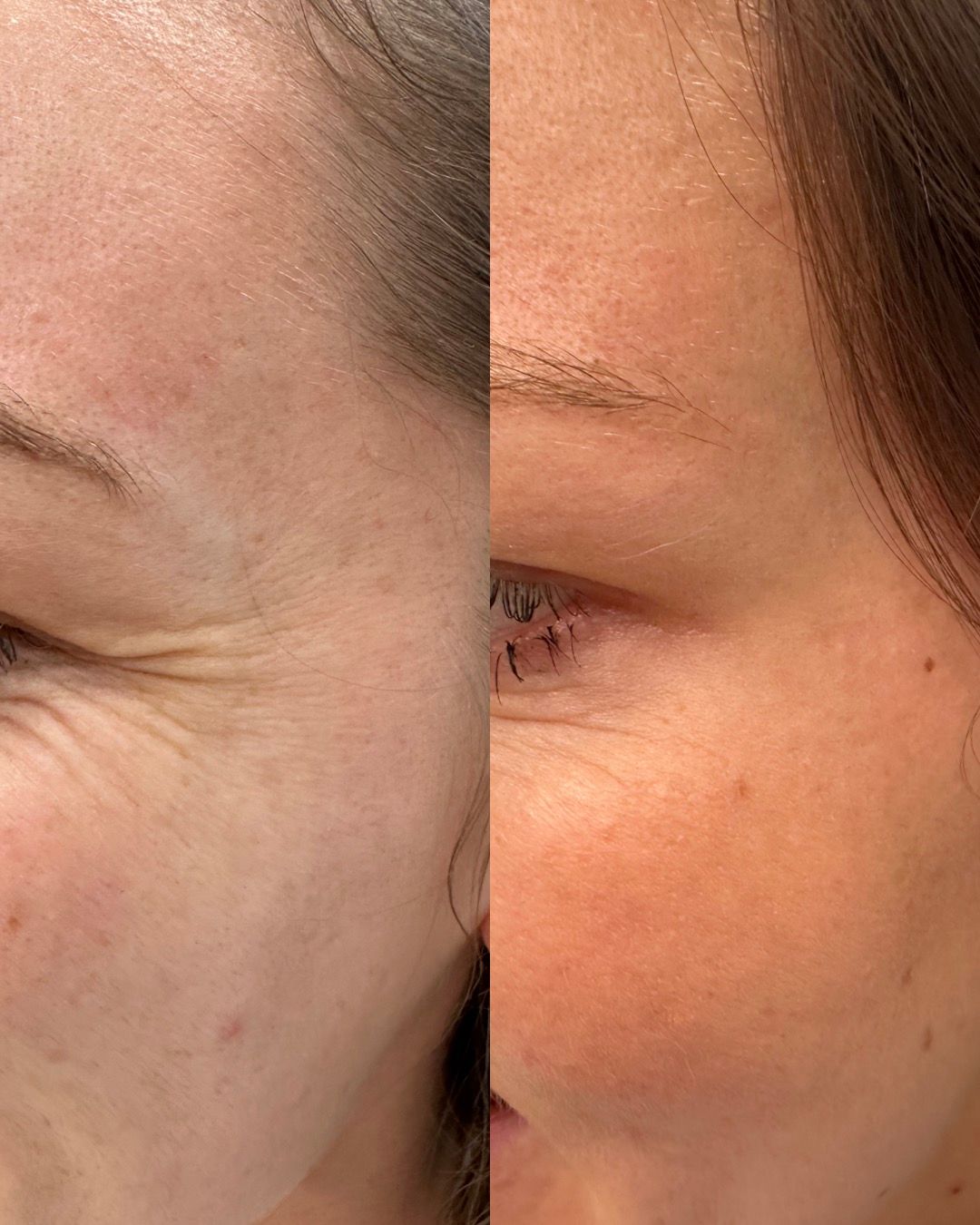 Michalina Zagańczyk-Bączek-29