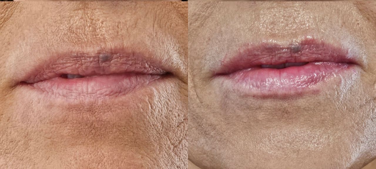 Rosalba Herrero Zerpa-27