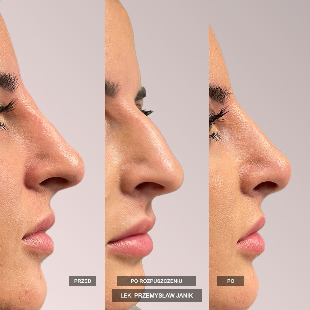 Przemysław Janik-44