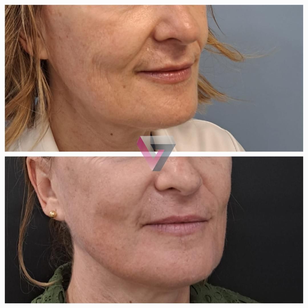 Victoria Trasmonte-85