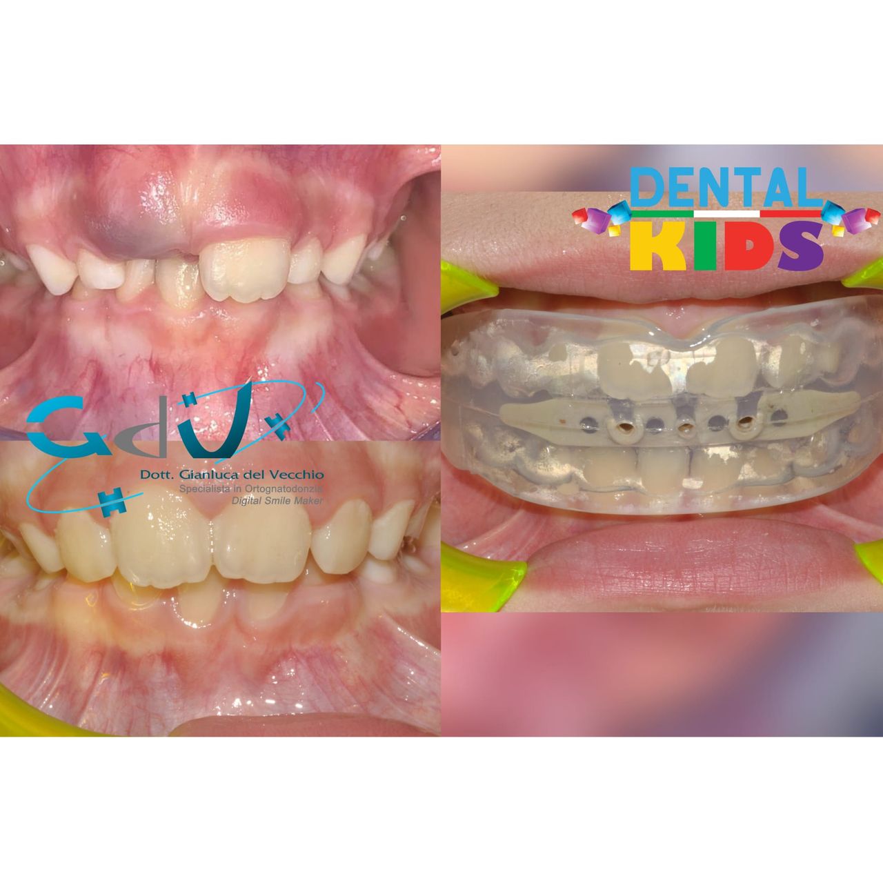 Gianluca Del Vecchio-173