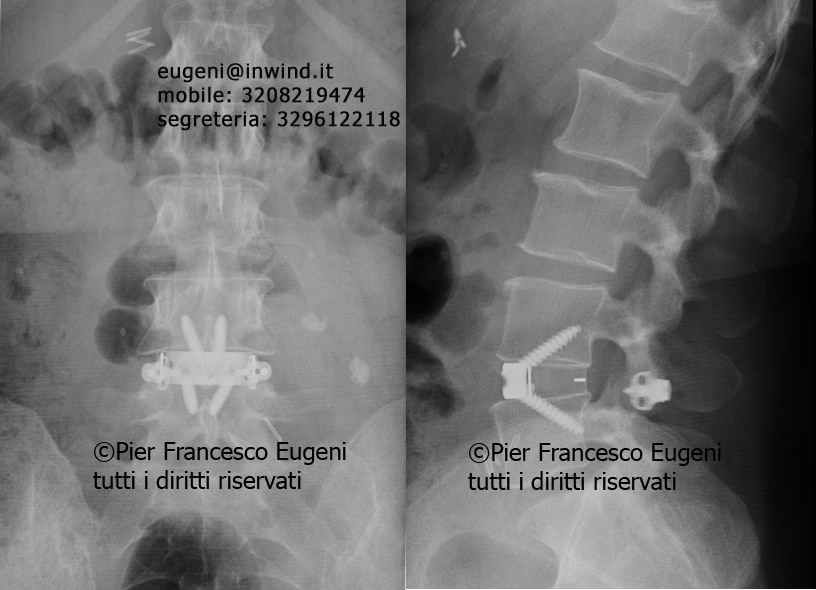 Pier Francesco Eugeni-5