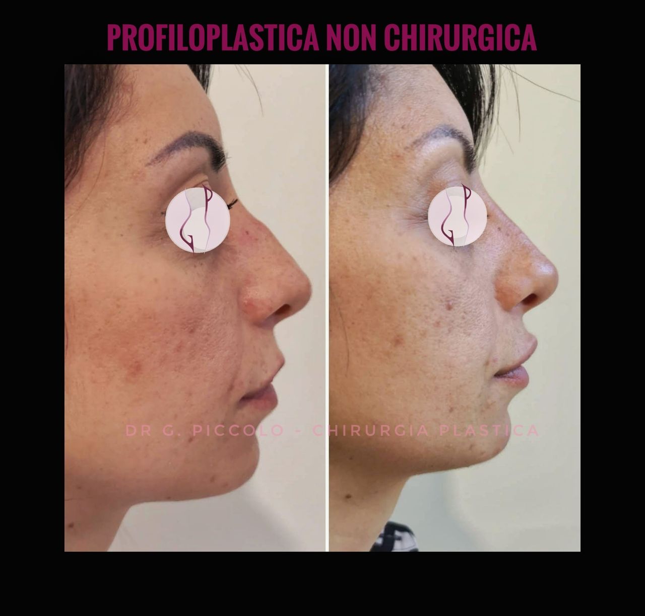 Giuseppina Piccolo-45