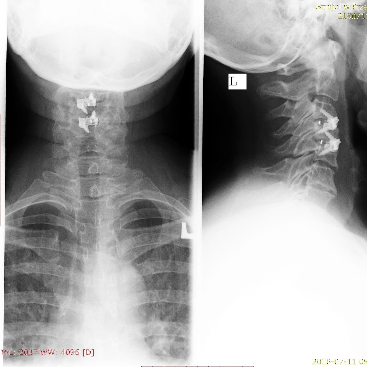 Jarosław Andrychowski-31