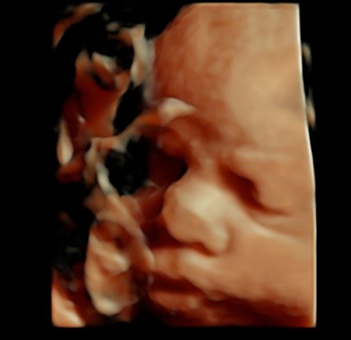 Tommaso Incandela-40