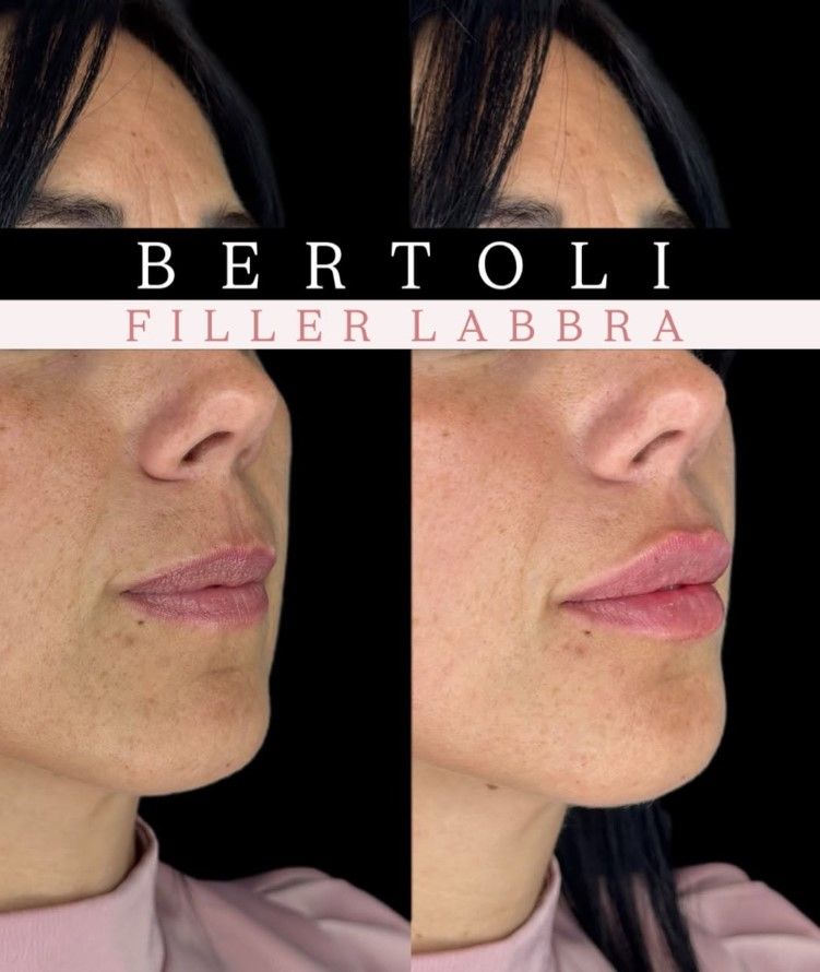 Andrea Bertoli-32