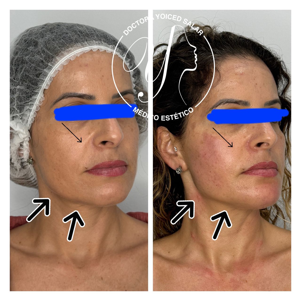 Yoiced Salar Peñate-30