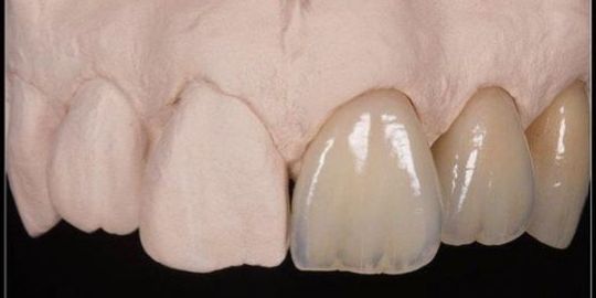 Stefano De Simone-120