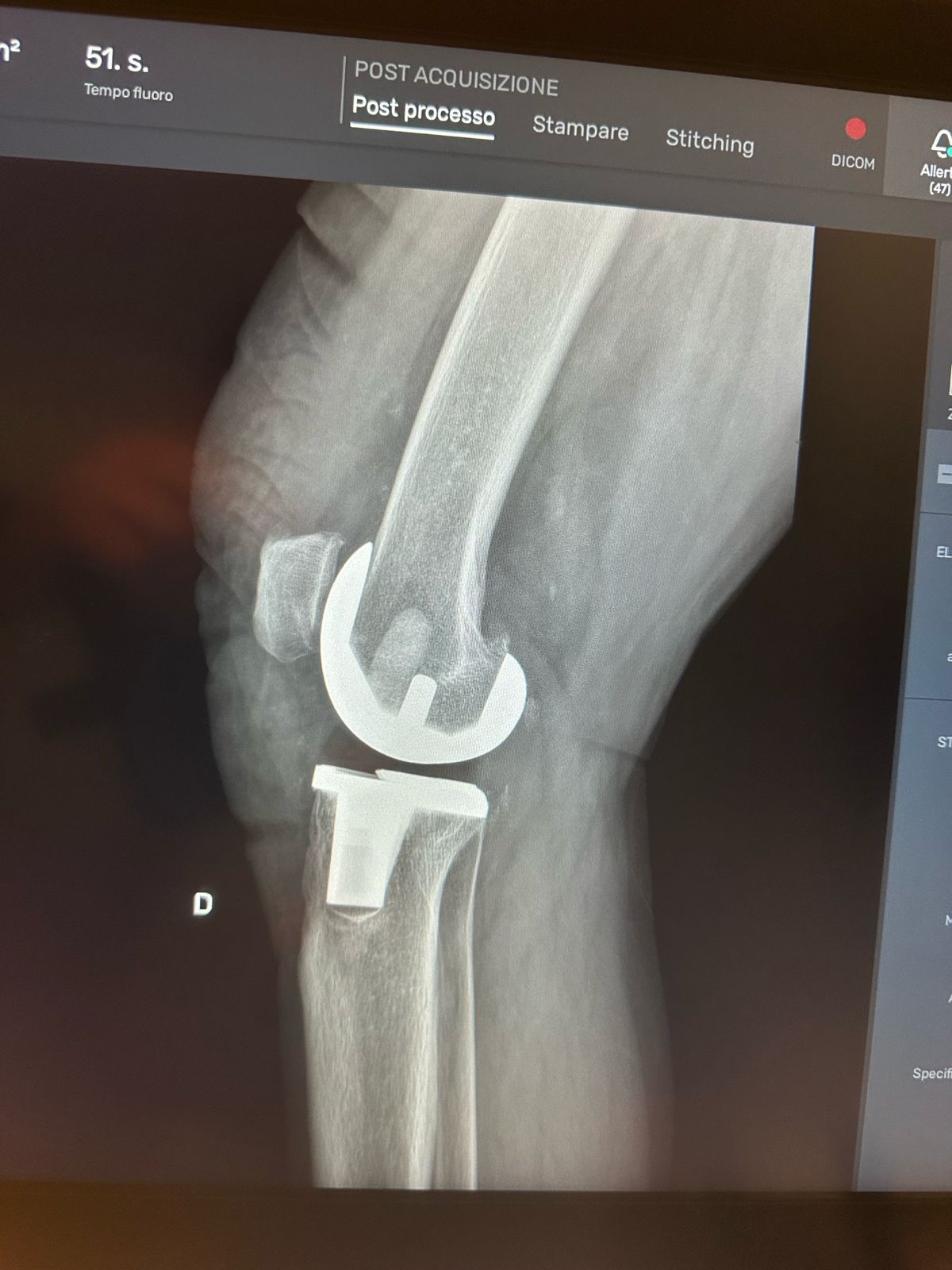 Valerio Cipolloni-34