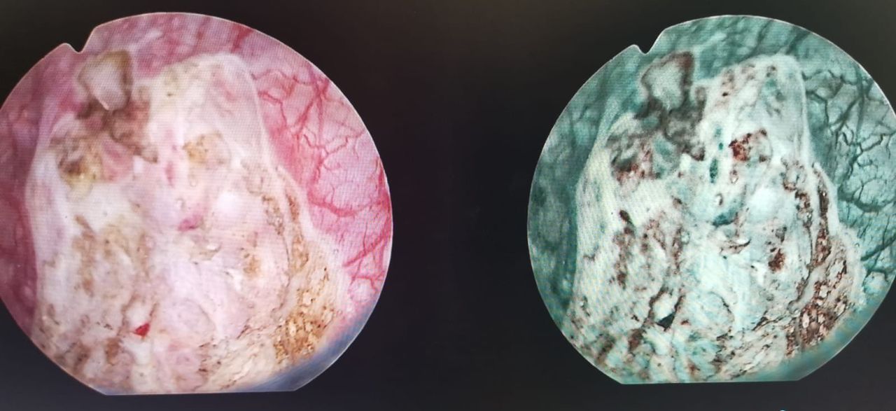 Şevket Tolga Tombul-3