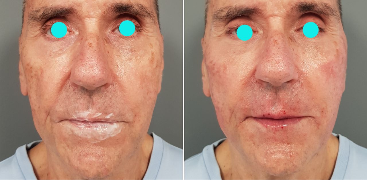 Rosalba Herrero Zerpa-471