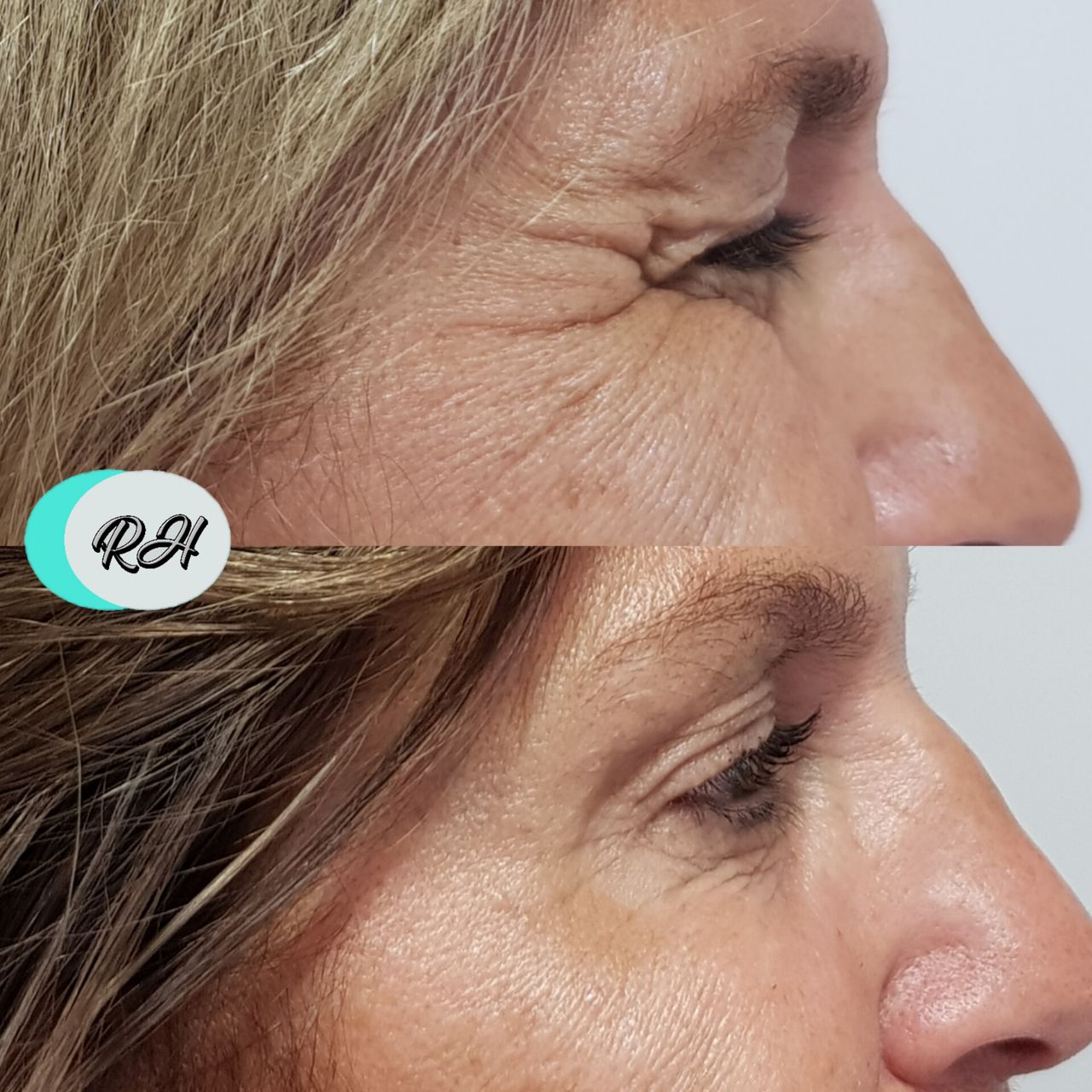 Rosalba Herrero Zerpa-100