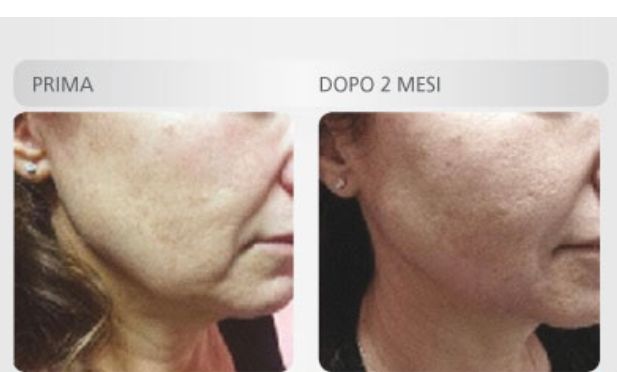 Pasquale Di Molfetta-5