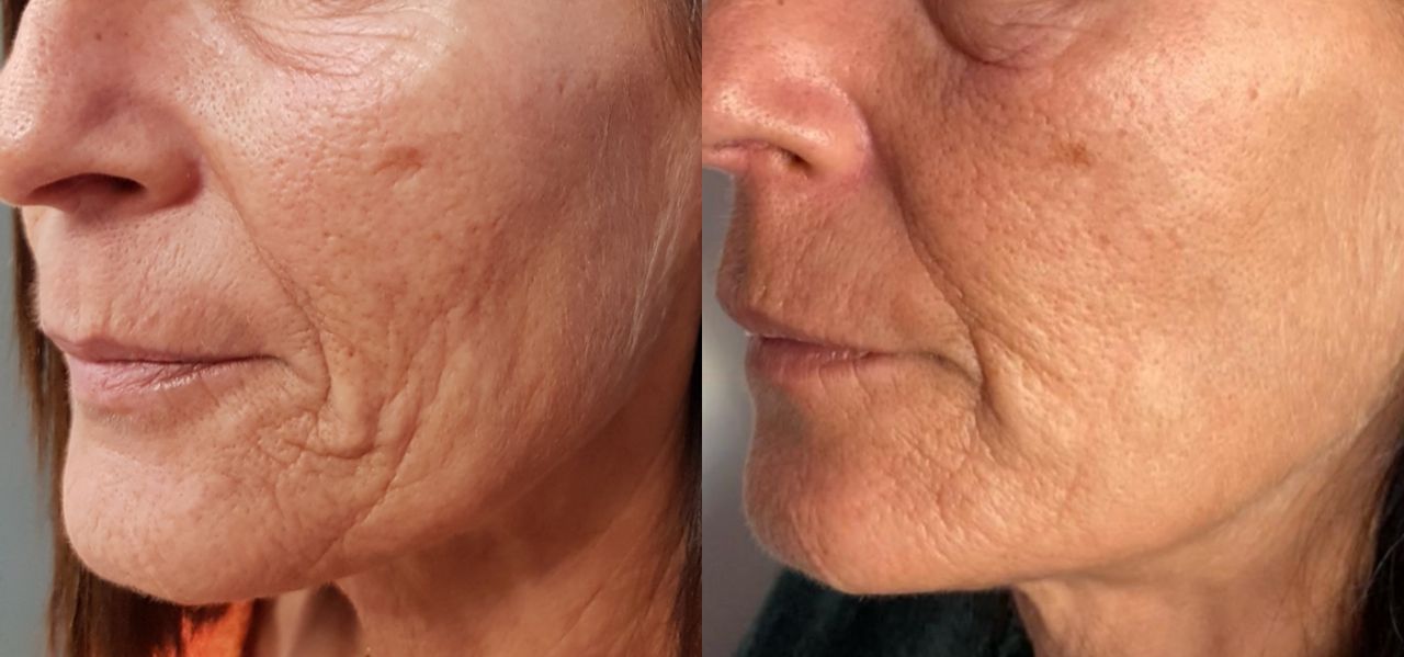 Rosalba Herrero Zerpa-52