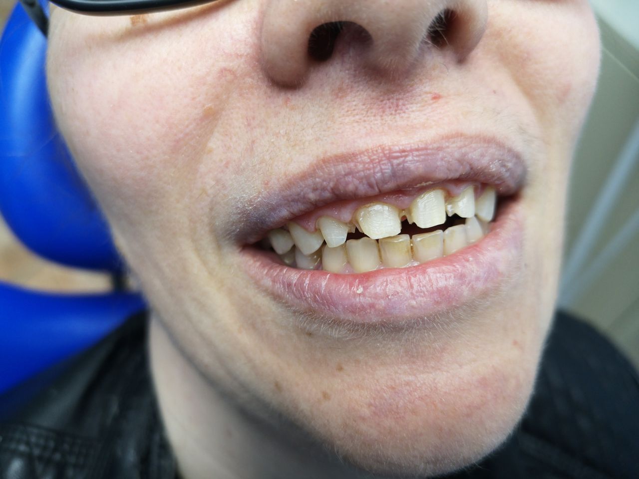 Stefano De Simone-113