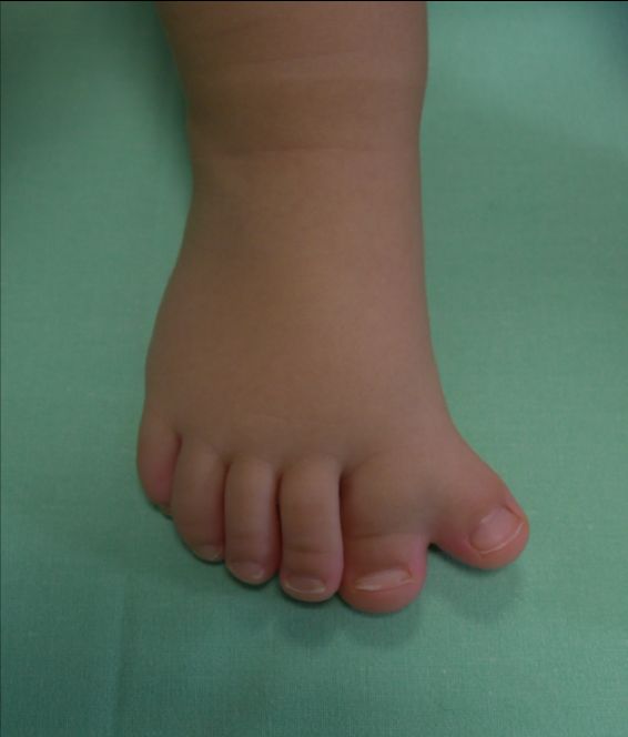 Giovanni Luigi Di Gennaro-6