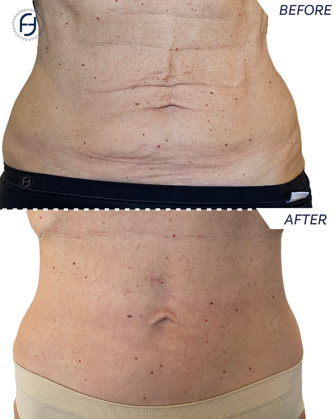 Francesca Flagiello-4