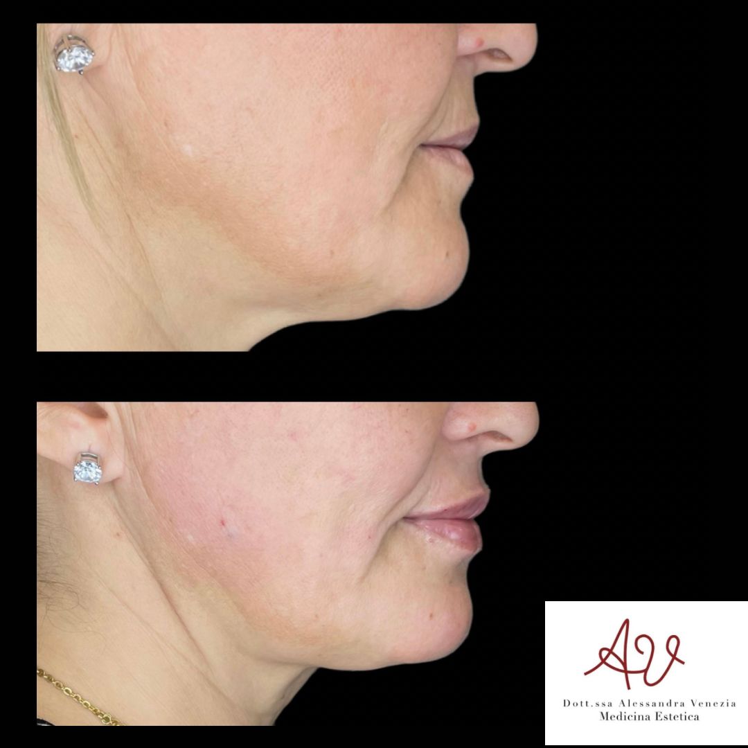 Alessandra Venezia-5