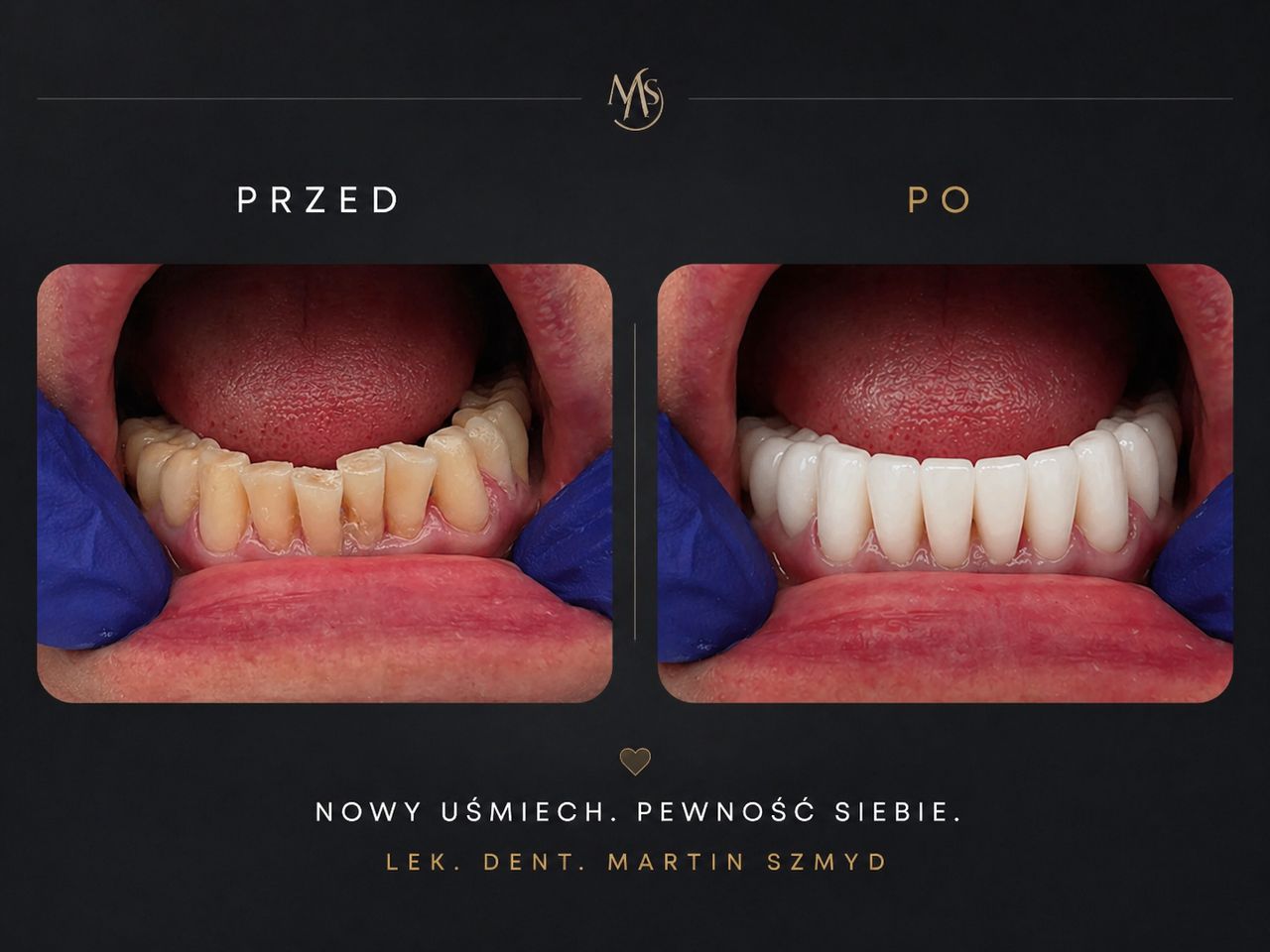 Martin Szmyd-0