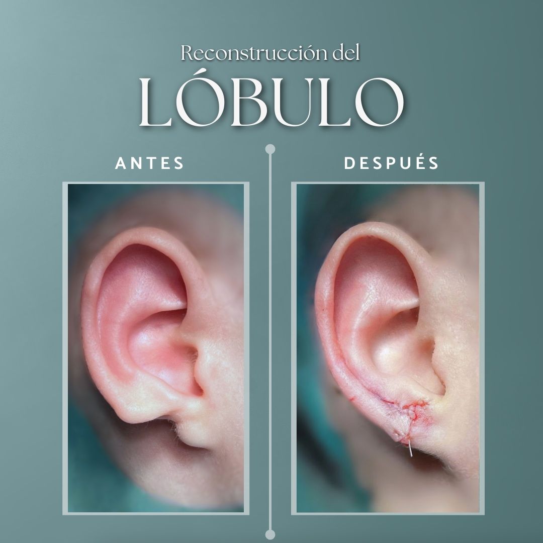 Concepción Lorca García-4