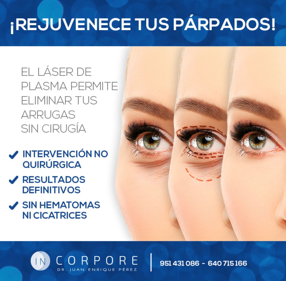 Juan Enrique Pérez Enríquez-17